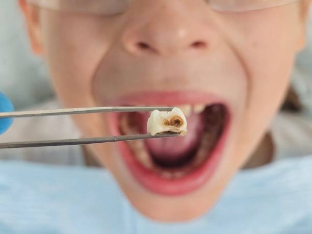 Best Emergency Root Canal Therapy in Wooster, AR